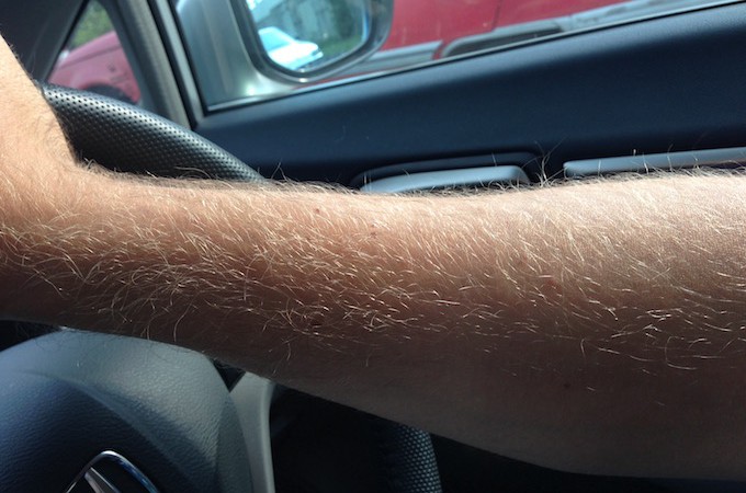 Hairy arms